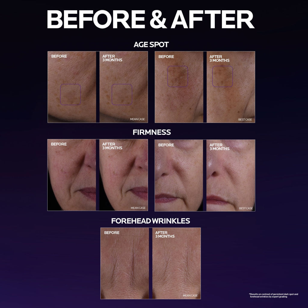 Mela B3 Double Dose Discoloration Treatment with Melasyl™