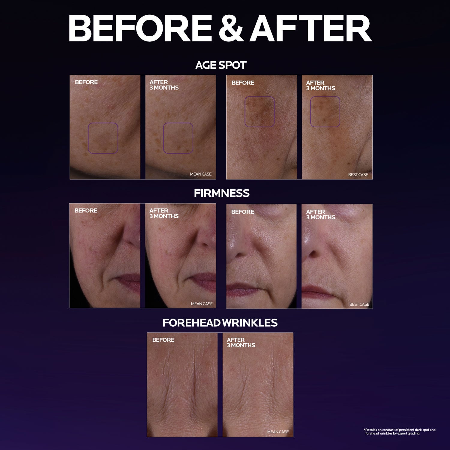 Mela B3 Double Dose Discoloration Treatment with Melasyl™
